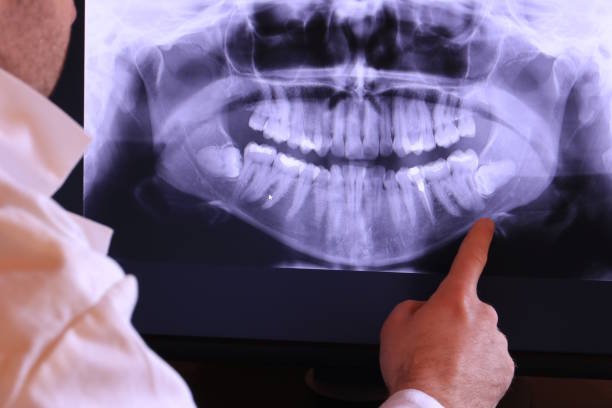 Best Urgent Care for Lost Fillings or Crowns in Clever, MO